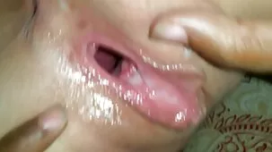 Labios vaginales